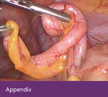 Appendix